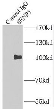 SENP5 Specific Rabbit Polyclonal Antibody