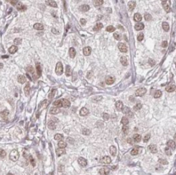SENP5 Specific Rabbit Polyclonal Antibody