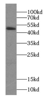SEPTIN6 Antibody