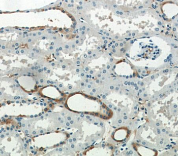 SLC5A4 Rabbit Polyclonal Antibody