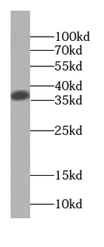 SGTA Antibody