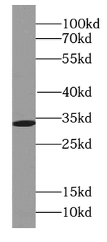 SLC25A6 Specific Rabbit Polyclonal Antibody