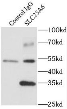 SLC25A6 Specific Rabbit Polyclonal Antibody