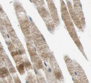 SLC25A6 Specific Rabbit Polyclonal Antibody