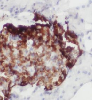 SST Rabbit Polyclonal Antibody