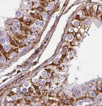 SPAG4 Specific Rabbit Polyclonal Antibody