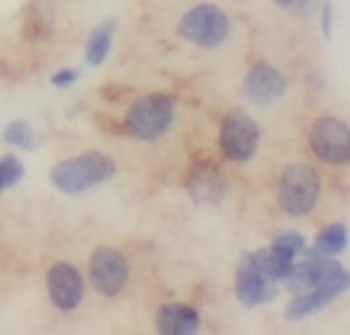 SPRR2F Antibody