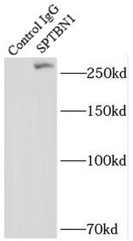 SPTBN1 Specific Rabbit Polyclonal Antibody
