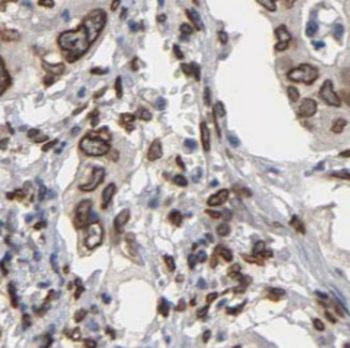 SPTBN1 Specific Rabbit Polyclonal Antibody