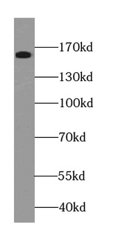 NCOA1 Rabbit Polyclonal Antibody