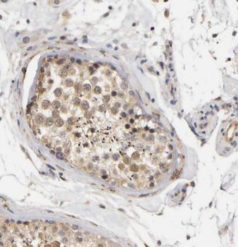 NCOA1 Rabbit Polyclonal Antibody