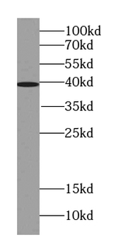 ST6GALNAC6 Mouse Monoclonal Antibody