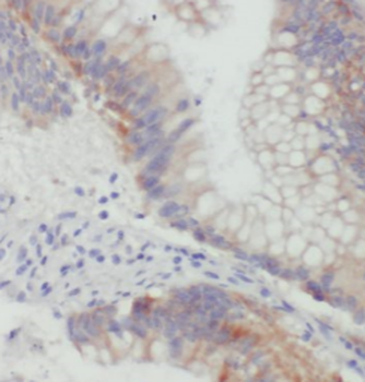 ST6GALNAC6 Mouse Monoclonal Antibody