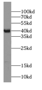 ST8SIA2 Antibody