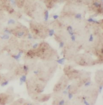 ST8SIA2 Specific Rabbit Polyclonal Antibody