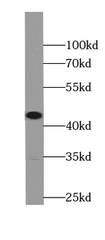 ST8SIA3 Antibody