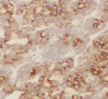 ST8SIA3 Rabbit Polyclonal Antibody