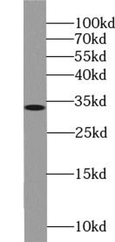 STC2 Mouse Monoclonal Antibody