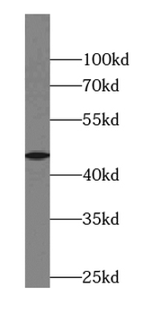 ABRA Rabbit Polyclonal Antibody