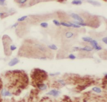 ABRA Rabbit Polyclonal Antibody