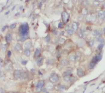 STXBP2 Mouse Monoclonal Antibody