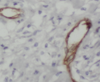 SULT1A4 Rabbit Polyclonal Antibody