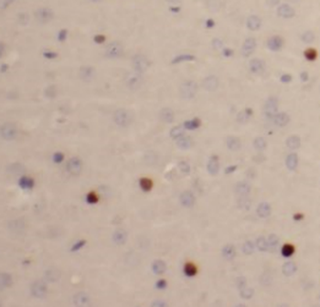 SULT4A1 Mouse Monoclonal Antibody