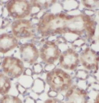SHOC2 Rabbit Polyclonal Antibody