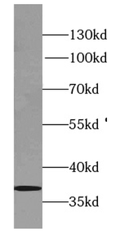SYNPR Antibody