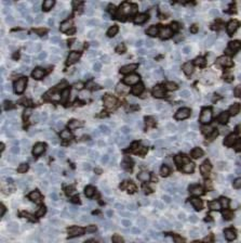 STX11 Rabbit Polyclonal Antibody