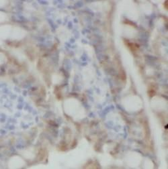STX16 Rabbit Polyclonal Antibody