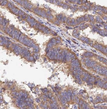 STX18 Rabbit Polyclonal Antibody