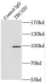 TBC1D5 Rabbit Polyclonal Antibody