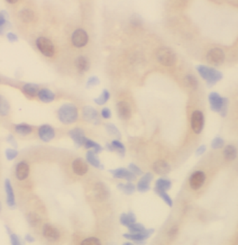 TBC1D5 Rabbit Polyclonal Antibody
