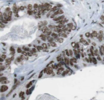 TARDBP Rabbit Polyclonal Antibody