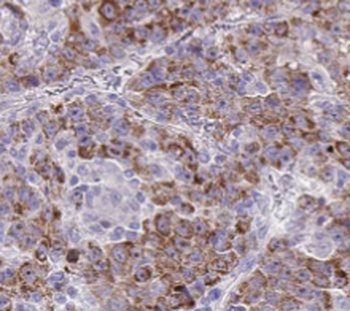 THBS3 Antibody
