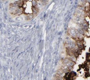 TIMM23 Rabbit Polyclonal Antibody