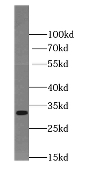 TIMMDC1 Antibody