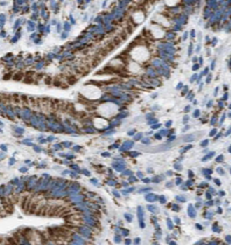 TINAG Rabbit Polyclonal Antibody