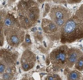 AGMO Rabbit Polyclonal Antibody