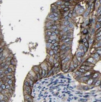 DRAM2 Rabbit Polyclonal Antibody