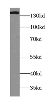 TPP2 Mouse Monoclonal Antibody