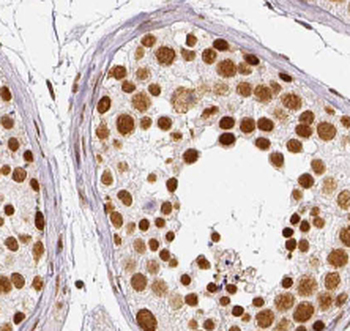 TPP2 Mouse Monoclonal Antibody