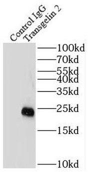 TAGLN2 Mouse Monoclonal Antibody
