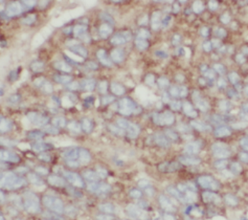 TAGLN2 Mouse Monoclonal Antibody