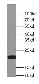 TAGLN specific Rabbit Polyclonal Antibody