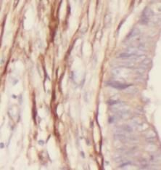 TAGLN specific Rabbit Polyclonal Antibody
