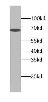 TKT Mouse Monoclonal Antibody