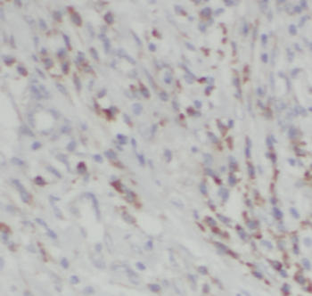 SSR2 Rabbit Polyclonal Antibody