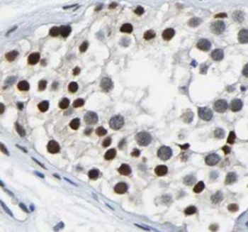 CEP41 Antibody